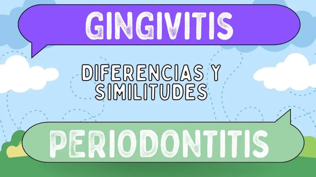 Diferencias entre gingivitis y periodontitis
